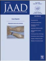 JAAD Interstitial Granulomatous... Anakinra