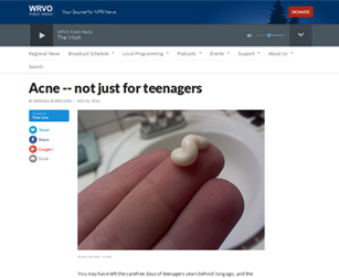 NPR WRVO Radio NY - Acne Is Not Just For Teenagers