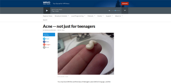NPR WRVO Radio NY - Acne Is Not Just For Teenagers