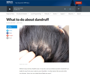 What to do about dandruff