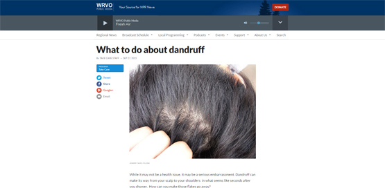 What to do about dandruff