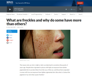 What are freckles and why do some have more than others?