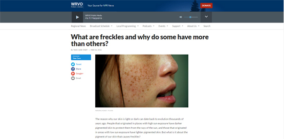 What are freckles and why do some have more than others?