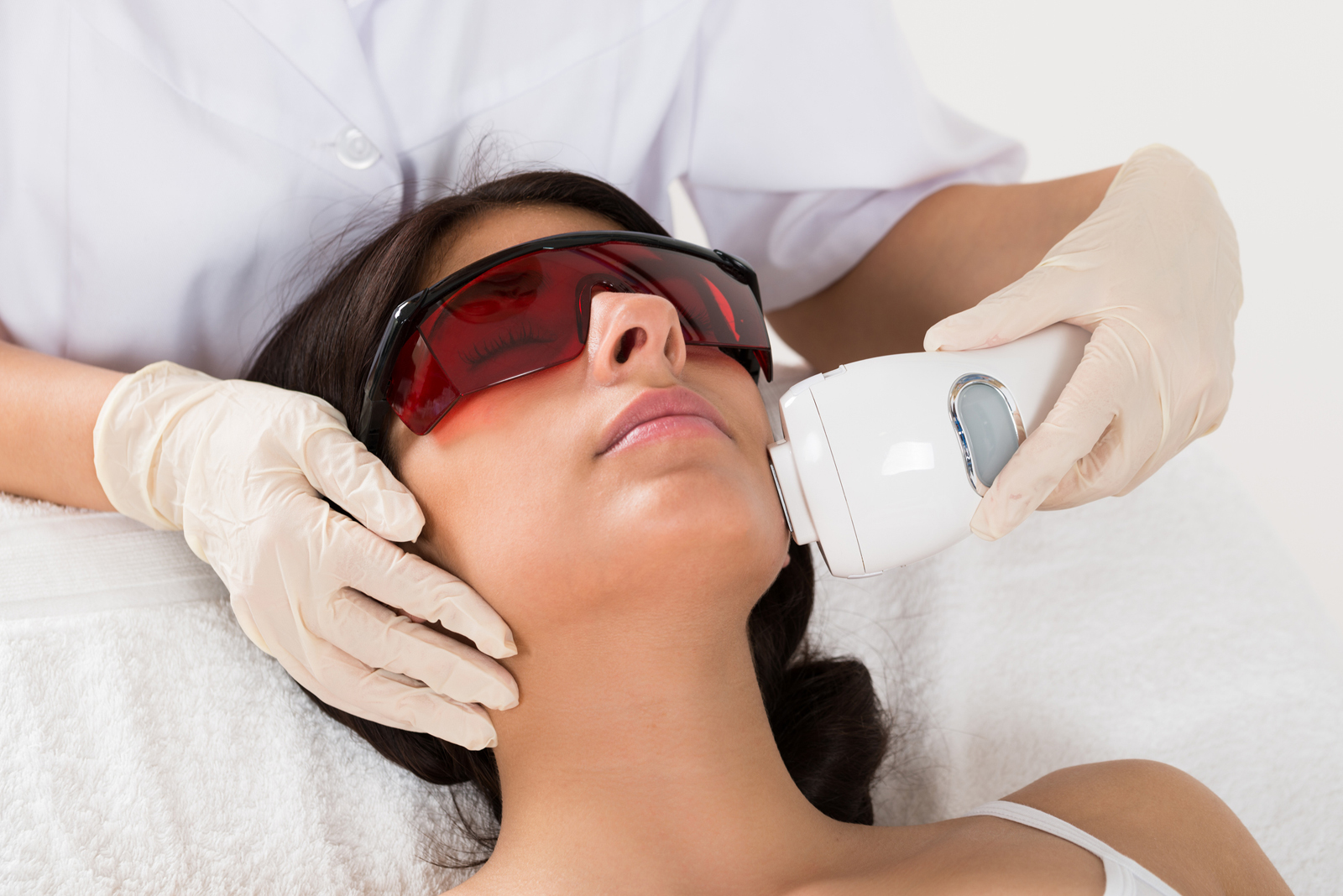 Laser Acne Treatment