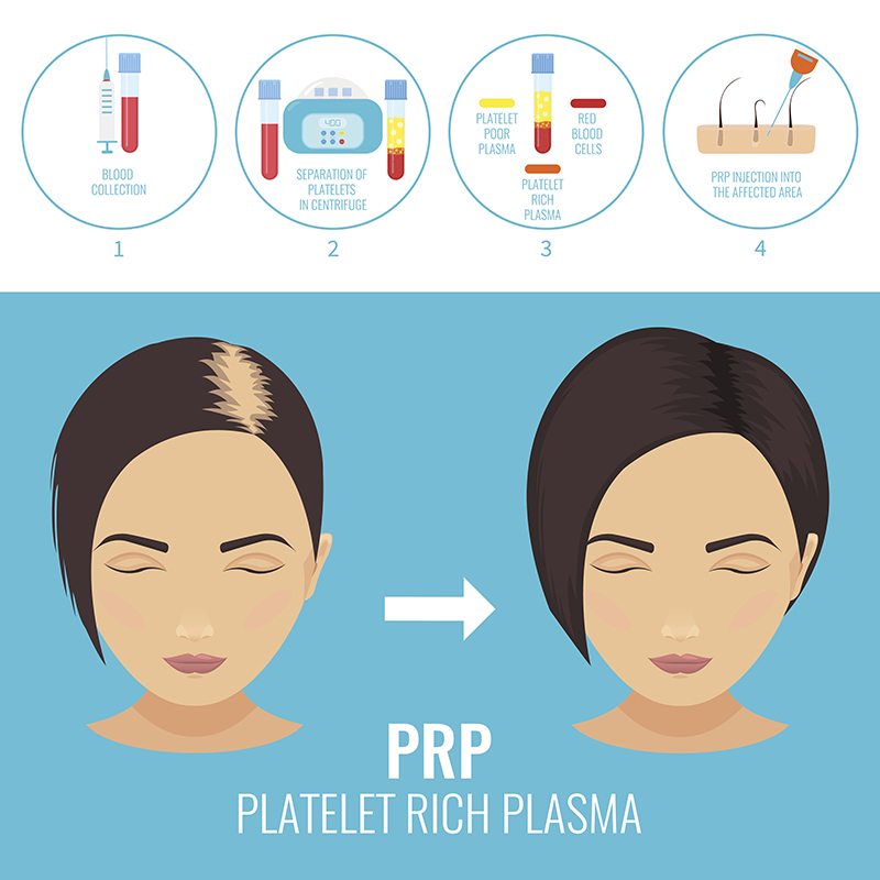 Woman before and after RPR therapy