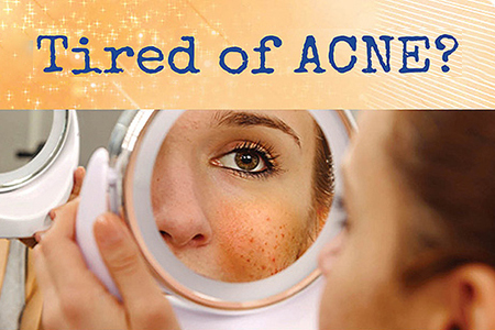 Tired of Acne