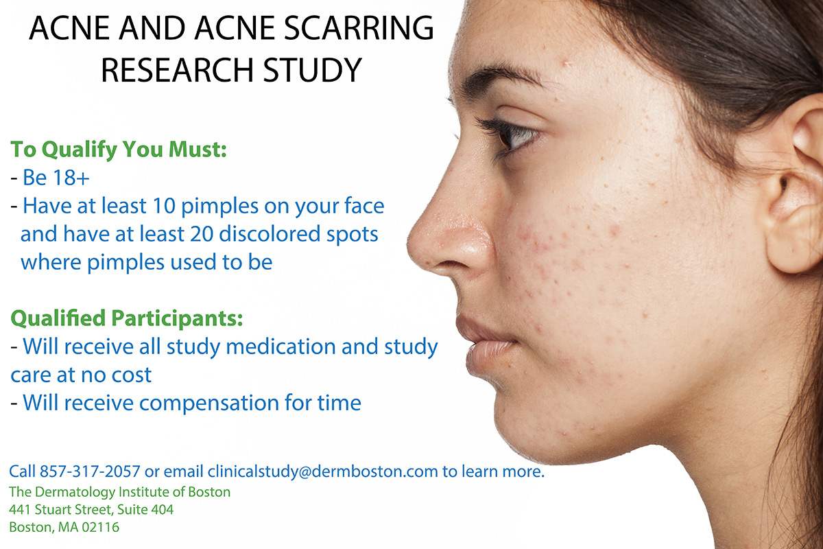 Boston Acne Dermatologist Medical Acne Treatment Boston