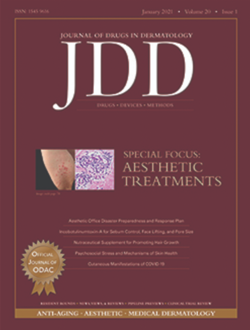 Successful Treatment of Periorificial Dermatitis With Novel Narrow Spectrum Sarecycline