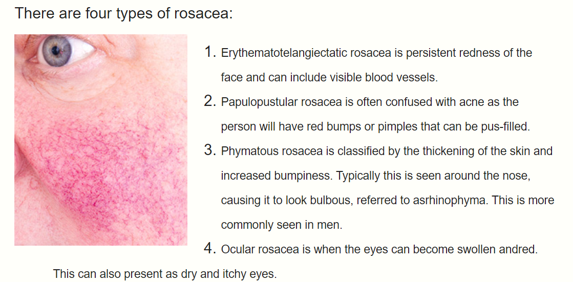 4 different types of rosacea