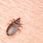 A bedbug on human skin