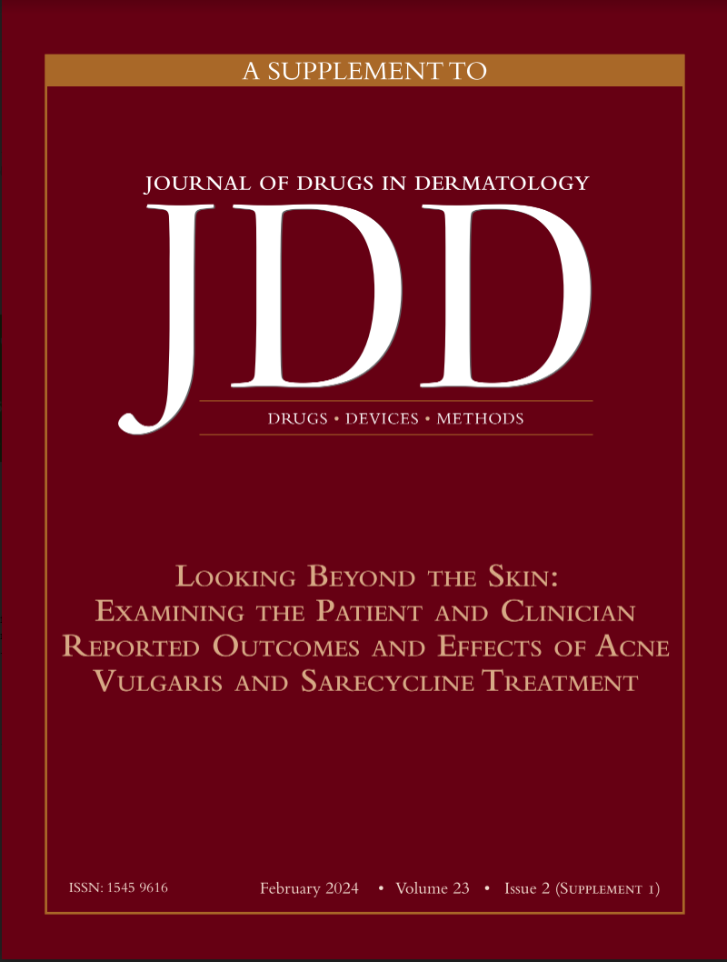 Looking Beyond the Skin, Examining the Patient and Clinician Reported Outcomes and Effects of Acne Vulgaris and Sarecycline Treatment