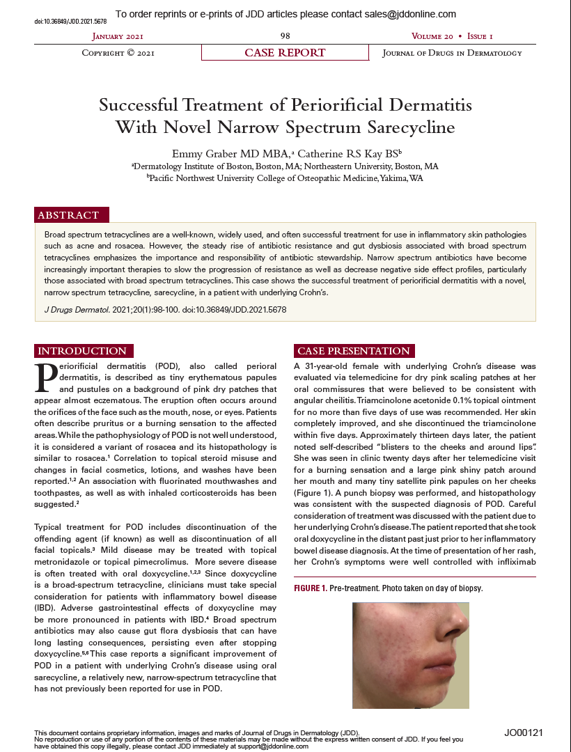 Successful Treatment of Periorificial Dermatitis With Novel Narrow Spectrum Sarecycline