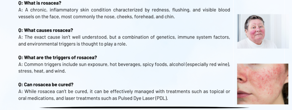 Rosacea Q&A
