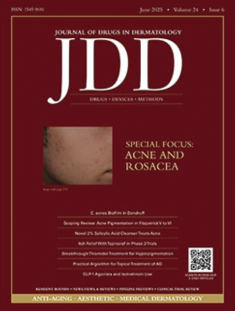 Study to Evaluate the Efficacy, Safety, and Tolerability of Sarecycline for Treating Periorificial Dermatitis