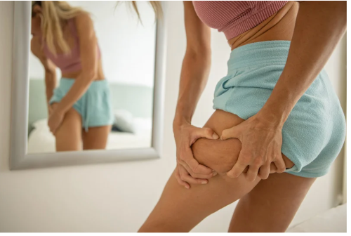 Trying on your bathing suit and seeing cellulite